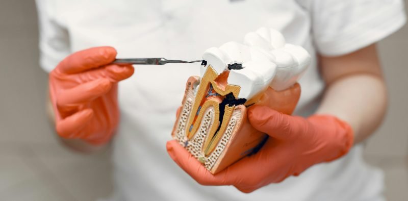 Close-up of dentist holding a tooth model, illustrating dental care concepts.